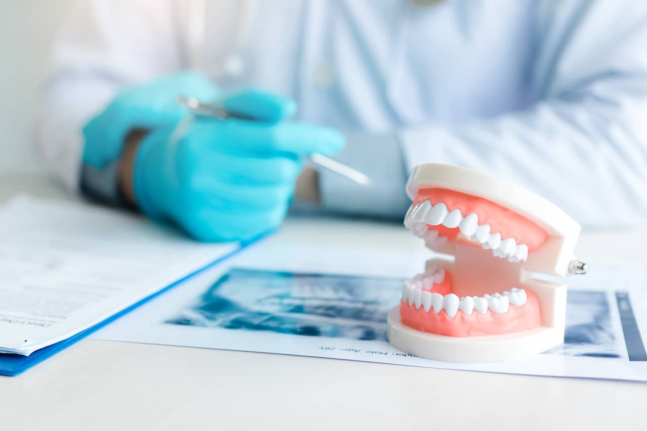 Delta Dental Implant Payment: How Much?
